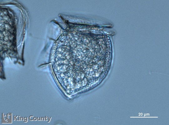 Photo of Dinophysis acuta/Dinophysis norvegica